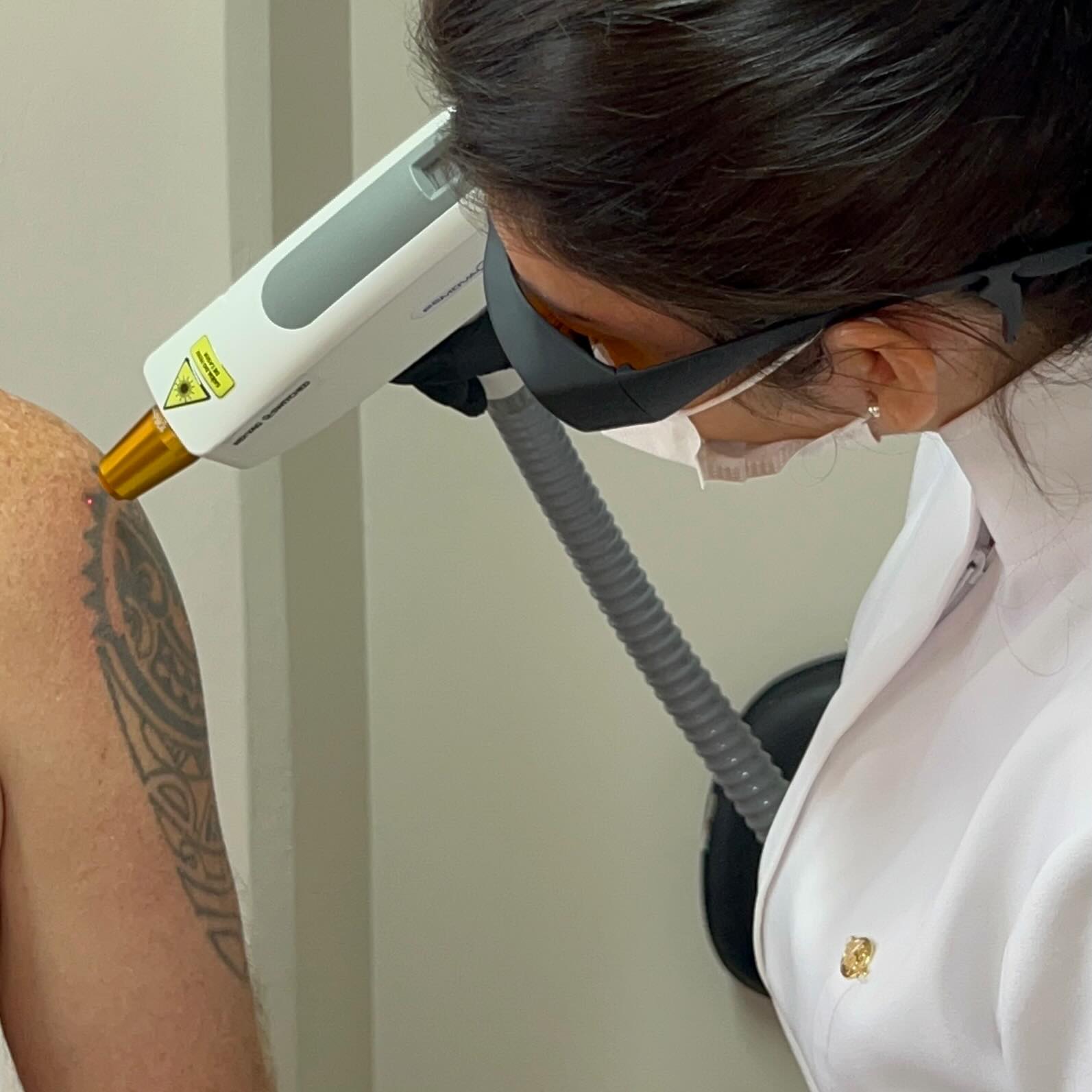 Angela Oliveira aplicando o laser em uma tatuagem